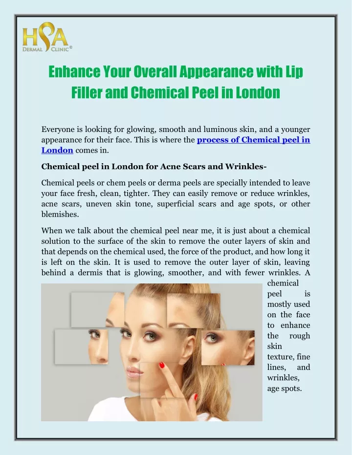enhance your overall appearance with lip filler