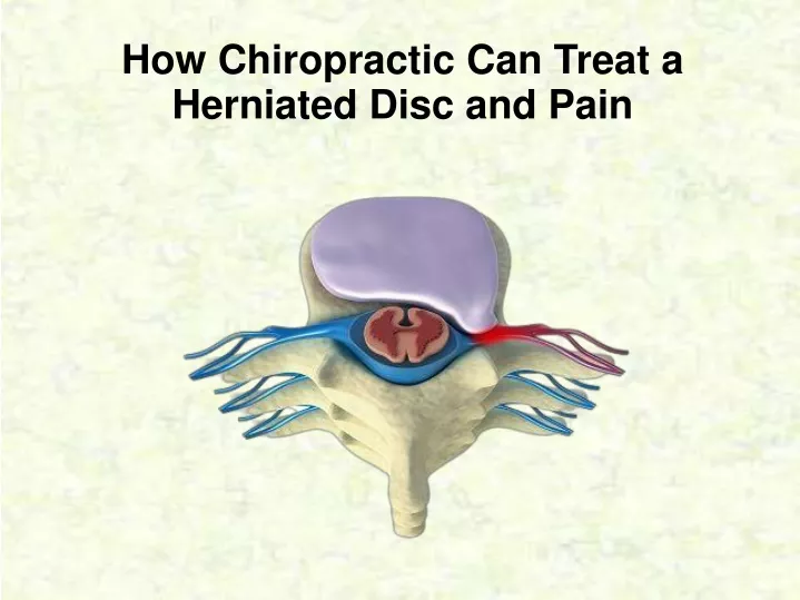 how chiropractic can treat a herniated disc