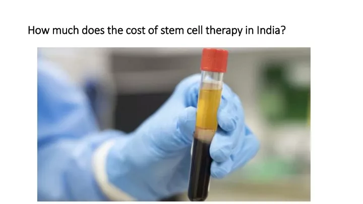 how much does the cost of stem cell therapy in india