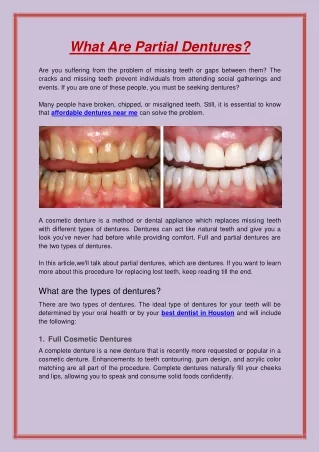 what are partial dentures