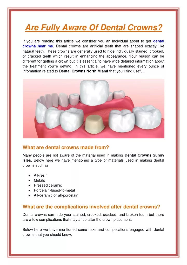 are fully aware of dental crowns