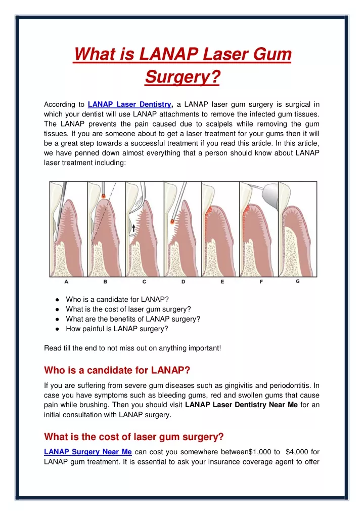 PPT - What Is LANAP Laser Gum Surgery PowerPoint Presentation, Free ...