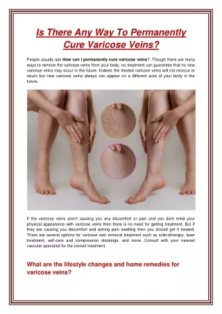 is there any way to permanently cure varicose