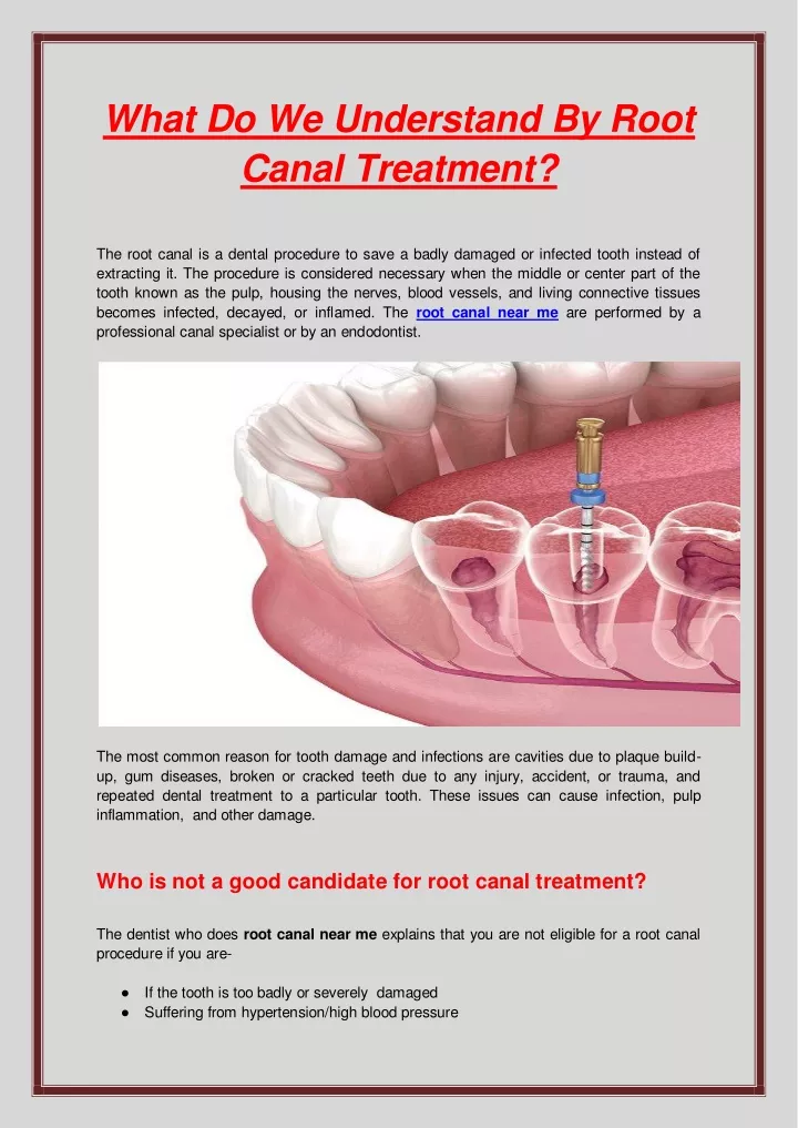 what do we understand by root canal treatment