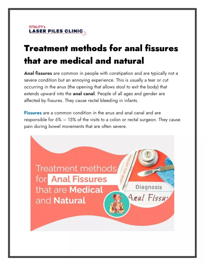 treatment methods for anal fissures that