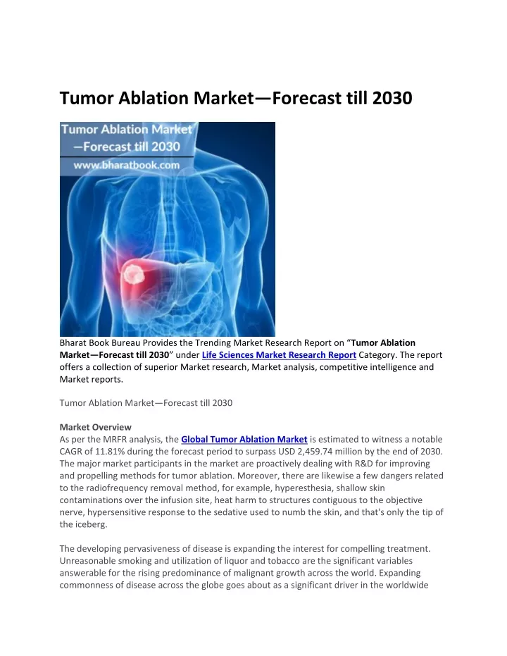 tumor ablation market forecast till 2030