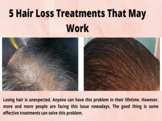 5 Hair Loss Treatments that May Work