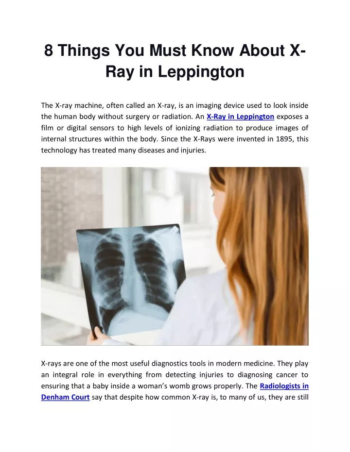 8 things you must know about x ray in leppington