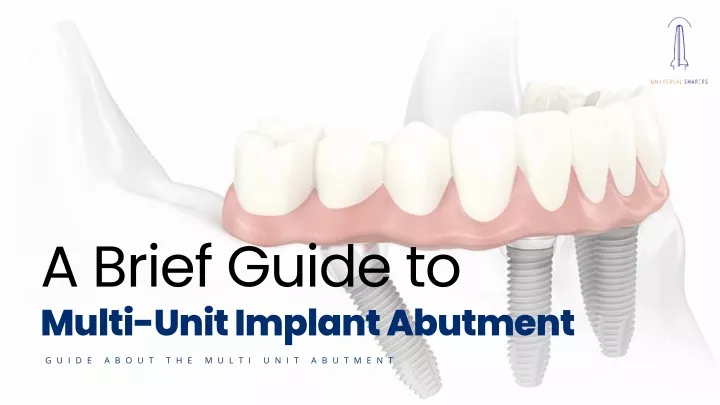 a brief guide to multi unit implant abutment