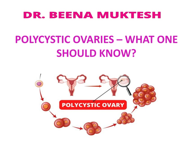 polycystic ovaries what one should know