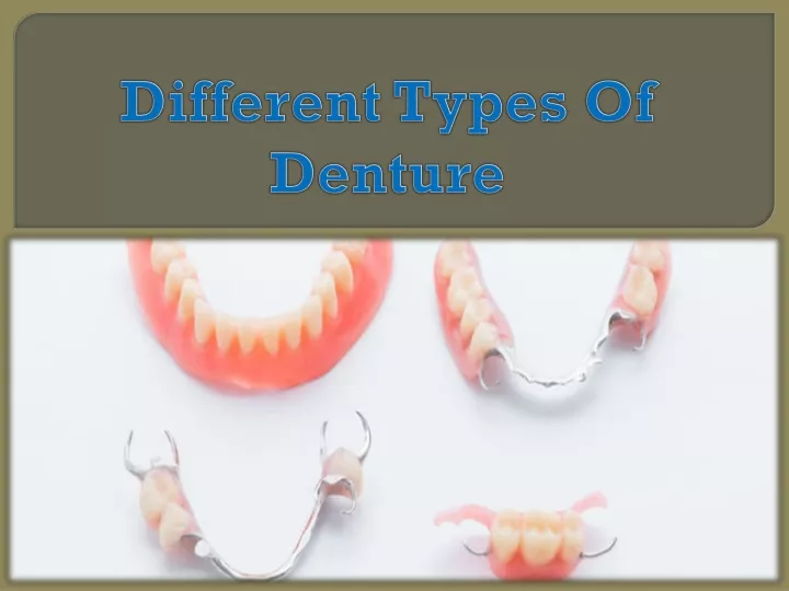 different types of denture