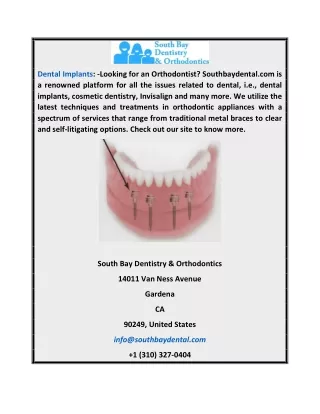 Dental Implants | Southbaydental.com