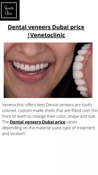 Dental veneers Dubai price ||Venetoclinic