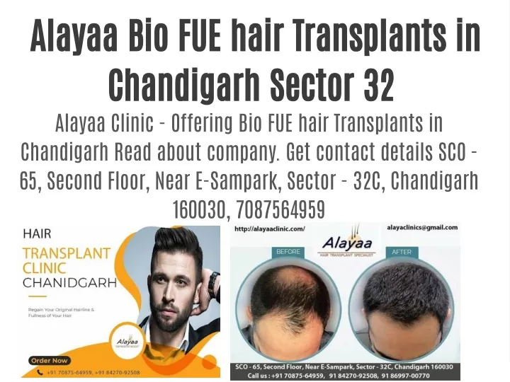alayaa bio fue hair transplants in chandigarh