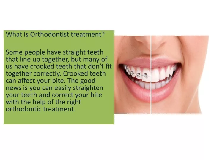 what is orthodontist treatment some people have