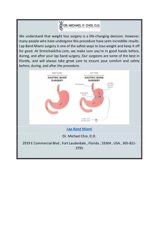 Lap Band Surgery by Top Rated Surgeons in Florida  Drmichaelchoi