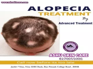 one of the best clinic for alopecia treatment in bhubaneswar, odisha