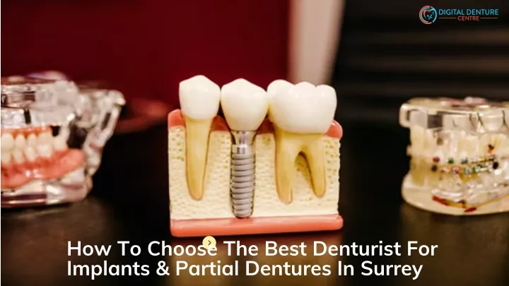 how to choose the best denturist for implants