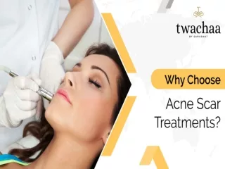 Why Choose Acne Scar Treatments?