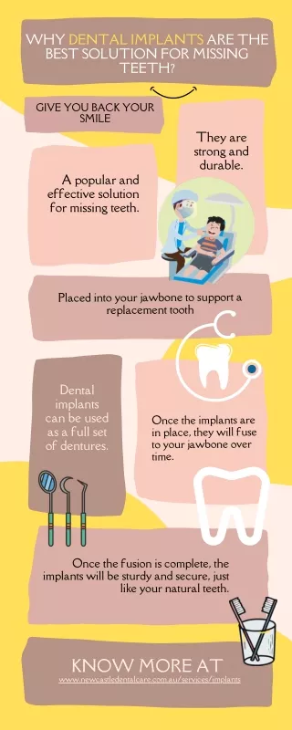 Why Dental Implants are the Best Solution for Missing teeth