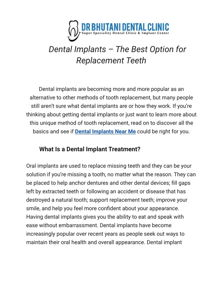 dental implants the best option for replacement