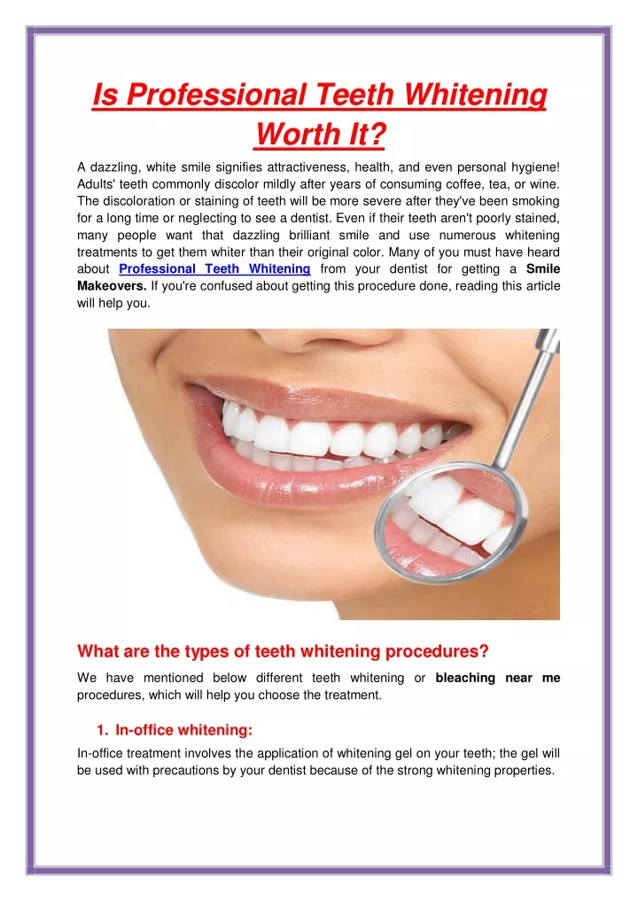 is professional teeth whitening worth it