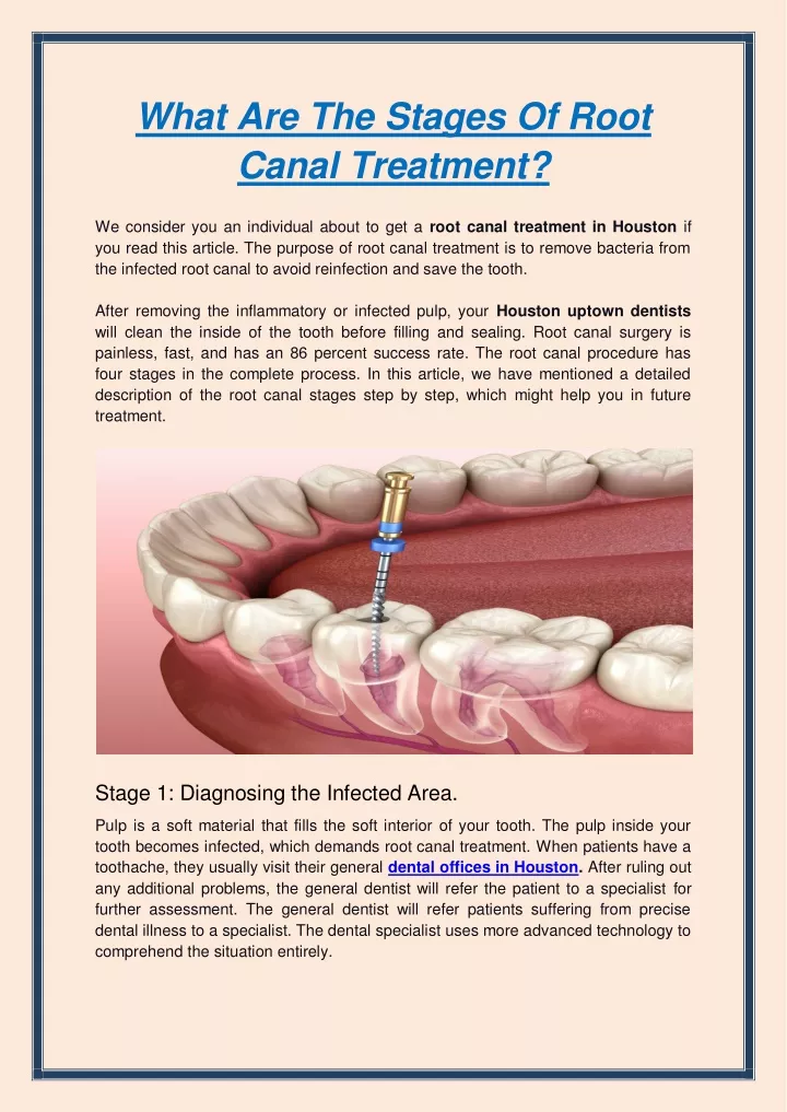 what are the stages of root canal treatment
