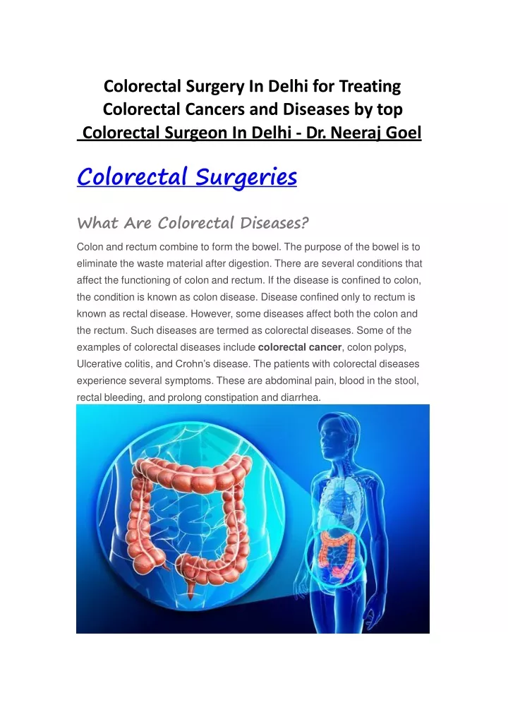 colorectal surgery in delhi for treating