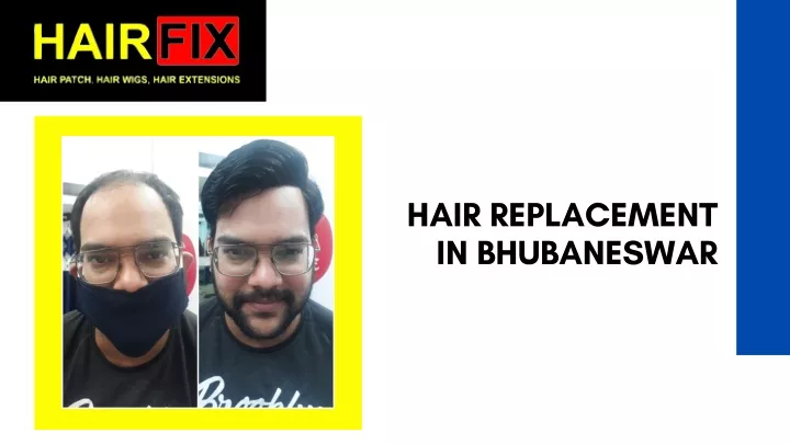 hair replacement in bhubaneswar