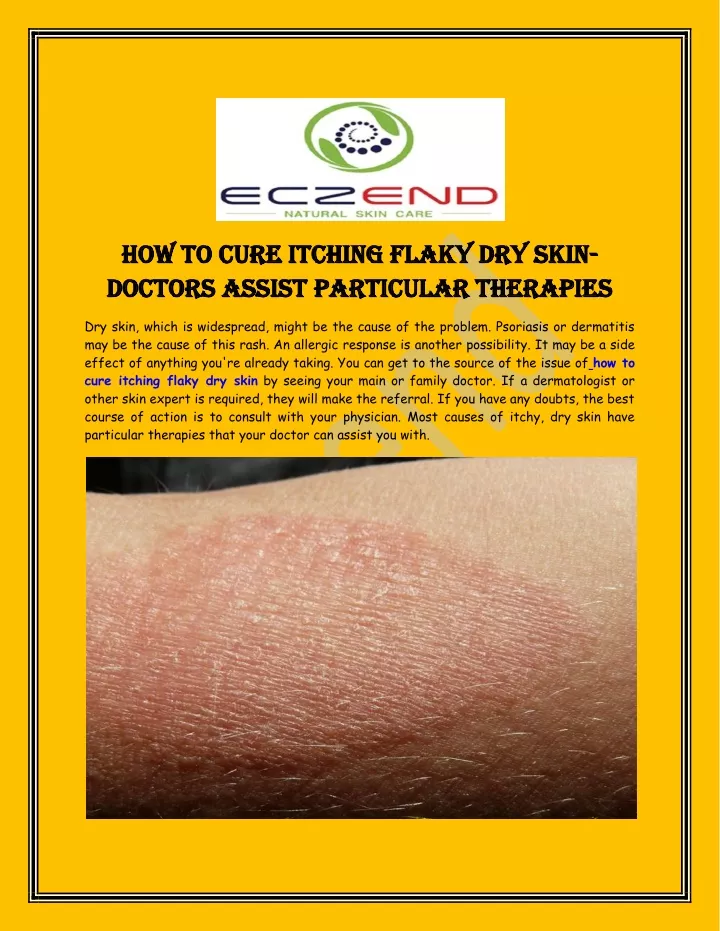 how to cure itching flaky dry skin how to cure