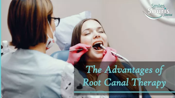 the advantages of root canal therapy