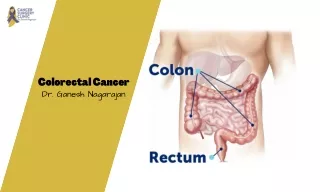 Best Doctor For Colorectal Cancer Treatment
