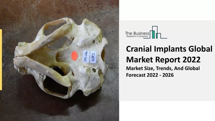 cranial implants global market report 2022 market