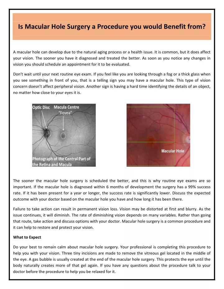 is macular hole surgery a procedure you would