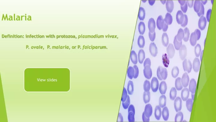 malaria definition infection with protozoa plasmodium vivax p ovale p malaria or p falciparum