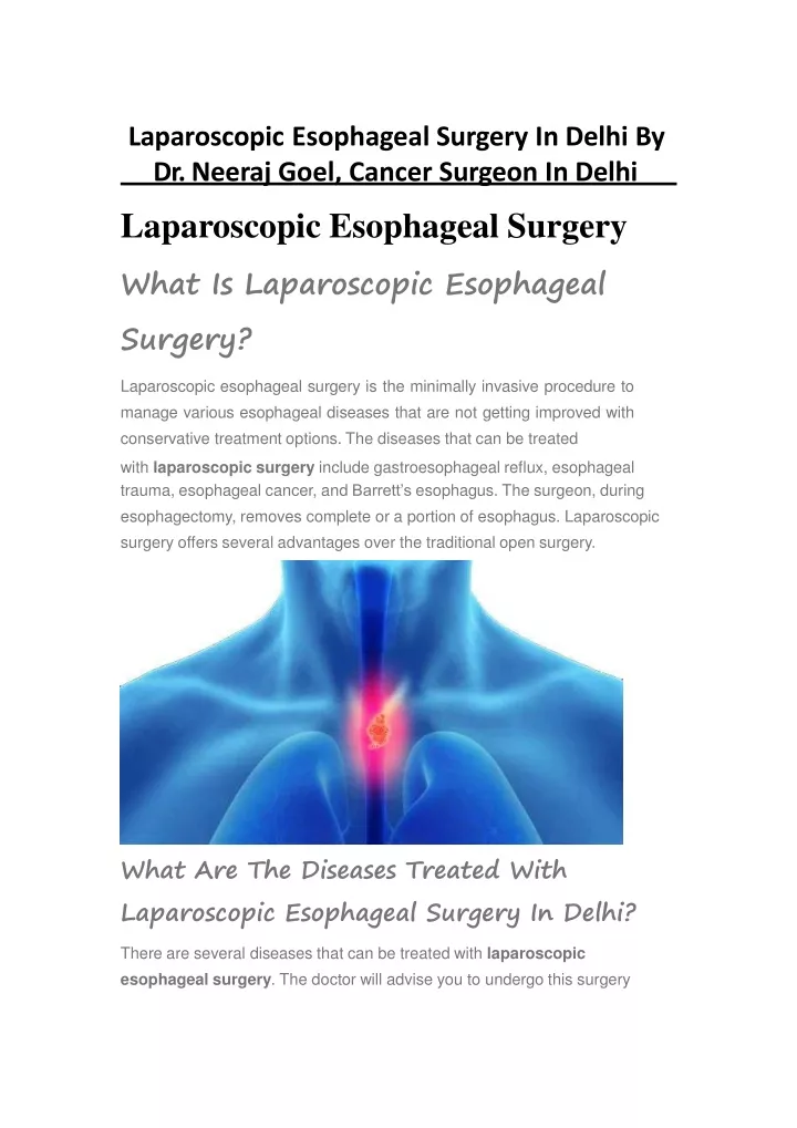 Ppt Laparoscopic Esophageal Surgery By Dr Neeraj Goel Cancer