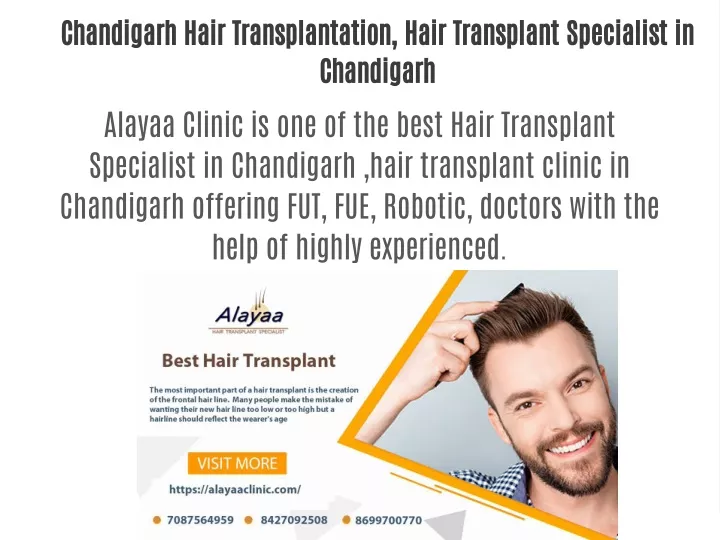 chandigarh hair transplantation hair transplant