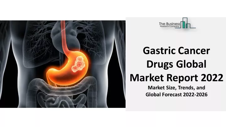 gastric cancer drugs global market report 2022