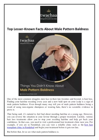 Top Lesser-Known Facts About Male Pattern Baldness