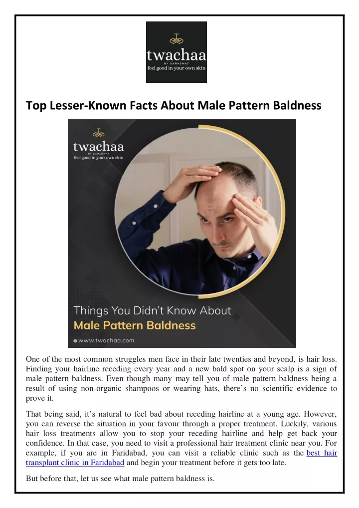 top lesser known facts about male pattern baldness