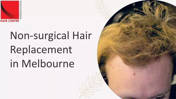 non surgical hair replacement in melbourne