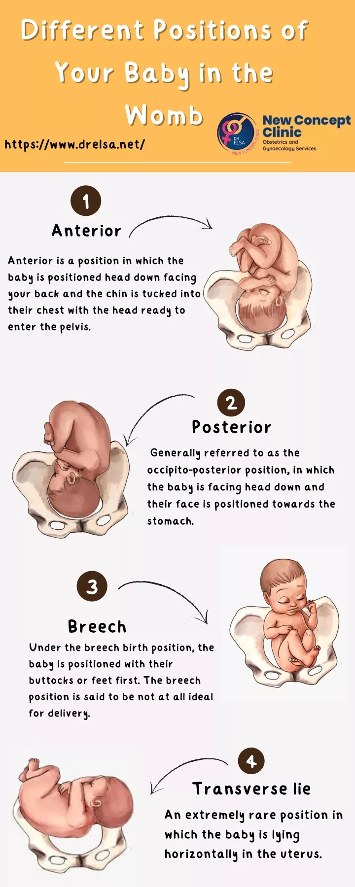 different positions of your baby in the womb