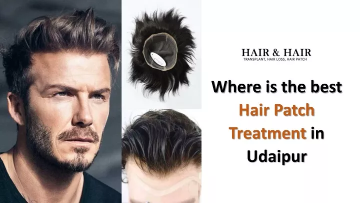 PPT - Where is the best Hair Patch Treatment in Udaipur PowerPoint  Presentation - ID:11407310