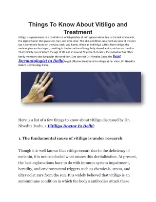 Things To Know About Vitiligo and Treatment