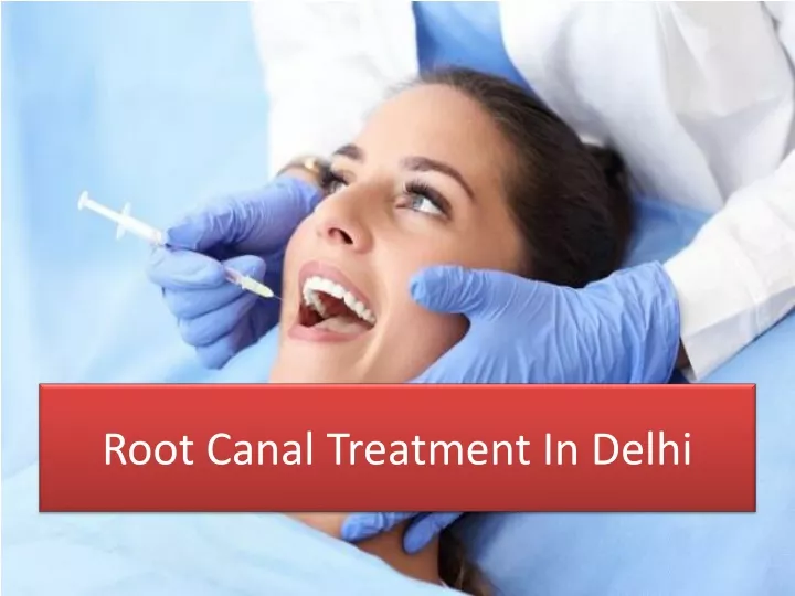 root canal treatment i n delhi