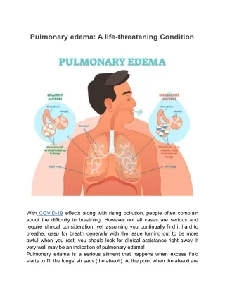 Pulmonary Edema - Causes, Symptoms and Treatment