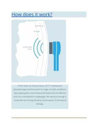 how does it work