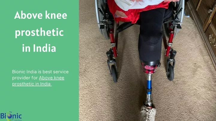 above knee prosthetic in india