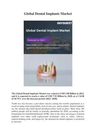 global dental implants market