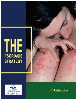 10 Natural Treatment Scalp Psoriasis at Home